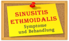 Sinusitis ethmoidalis